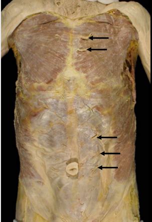 dissection  cadaver  flashcards quizlet