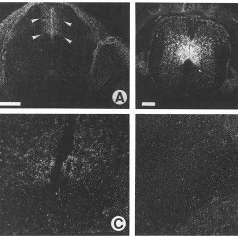 Ptn Mrna Expression Is Developmentally Regulated In The Spinal Cord