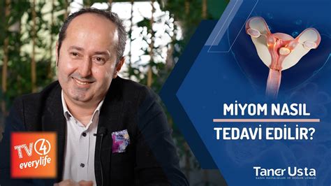 Miyom Nas L Tedavi Edilir Prof Dr Taner Usta Youtube