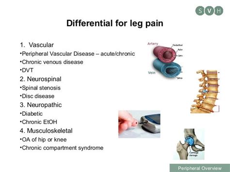 Determining a vascular cause for leg pain and referrals