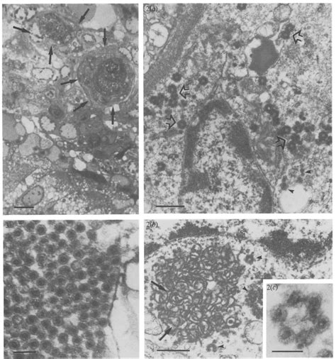 Semitbin Section Of Infected Hepatopancreas Of C Mediterraneus Download Scientific Diagram