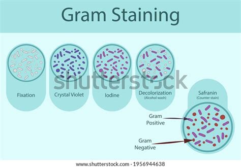 1,666 Bacteria Gram Stain Images, Stock Photos & Vectors | Shutterstock