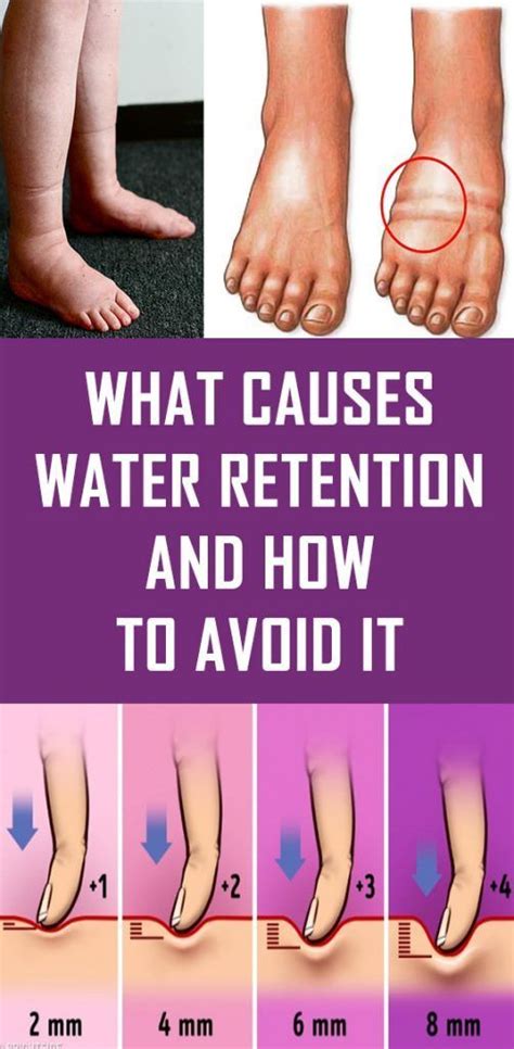 Water Retention Causes