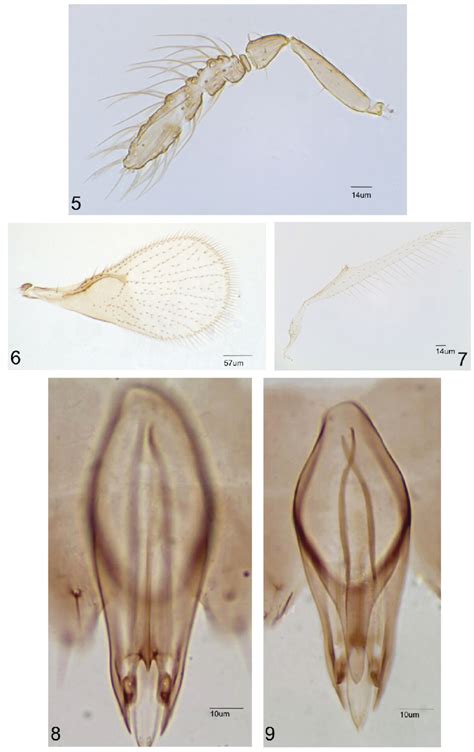 Trichogramma Valmiri Sp Nov Male 5 Antenna 6 Forewing 7 Download Scientific Diagram