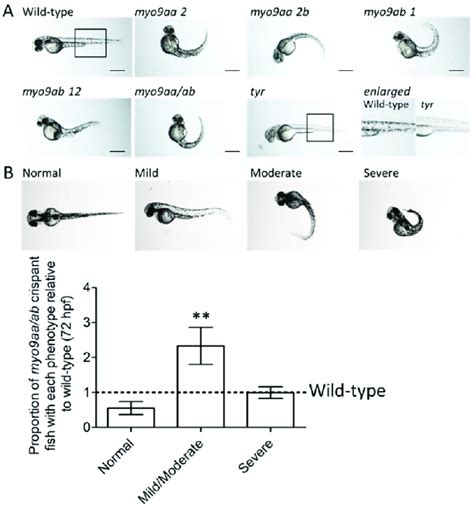 Phenotypes Of Myo Aa Ab Crispant Zebrafish A Representative Images