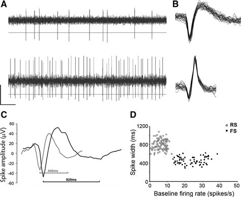 Spike Detection And Classification Of Rs And Fs Neurons Unit Isolation