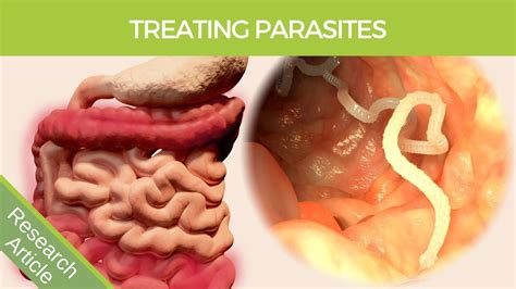 Parasite Cleanse Nz Proven Detox For Gut Health