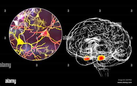 Anatomie du cerveau amygdale Banque de photographies et dimages à