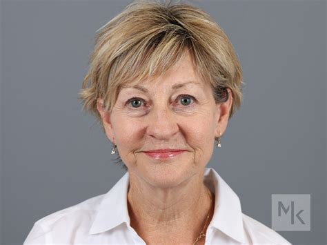 Facelift Before And After 28 Dr Michael Kim