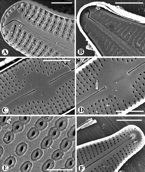 Additional Scanning Electron Micrographs Of External A C E And