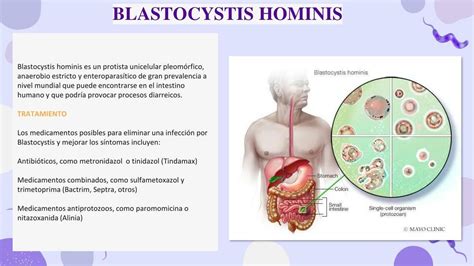 Blastocystis hominis Medicina Óptima uDocz