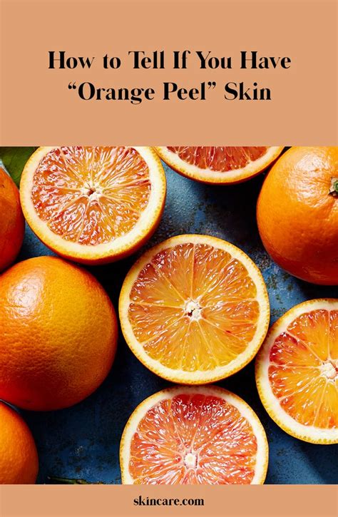 Orange Peel Skin What Is It Causes And How To Fix It