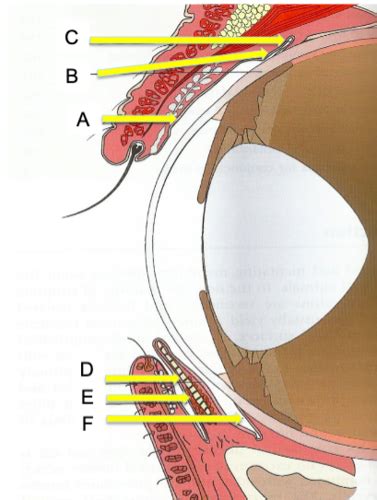 Conditions Of The Conjunctiva Flashcards Quizlet