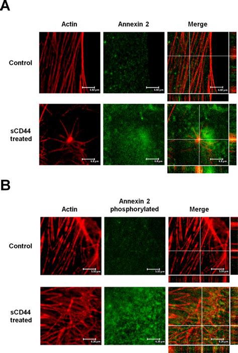 Confocal microscopy of sCD44-treated human trabecular meshwork cells.... | Download Scientific ...