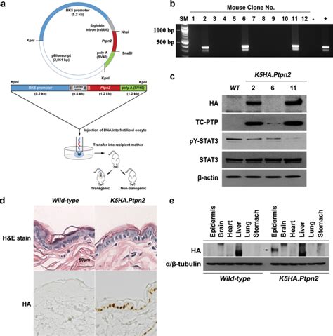 Overexpression Of Tc Ptp In Murine Epidermis Attenuates Skin Tumor