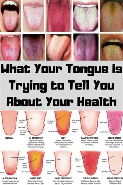 What Your Tongue Is Trying To Tell You About Your Health Healthy Tongue Tongue Health Health