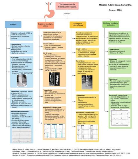 Trastornos De La Motilidad Esof Gica Iovanny Cruz Ojeda Udocz