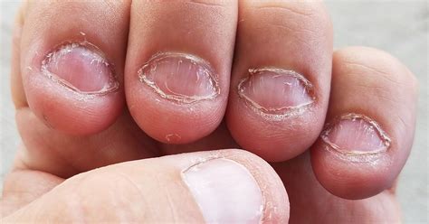 10 Tips To Stop Biting Your Nails Once And For All Bright Side