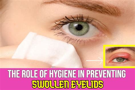 Swollen Eyelids Prevention The Role Of Good Hygiene