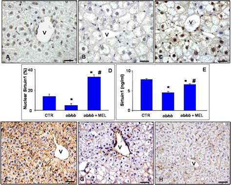 Liver Sirt1 And β Catenin Immunostainings Hepatic Immunostaining For Download Scientific