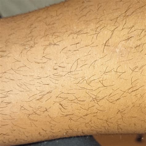 Pili Multigemini After Shaving Everywhere Rhairremoval