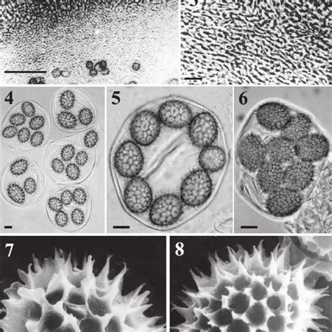 Tuber Pseudoexcavatum Wang Et Al Detail Of The External