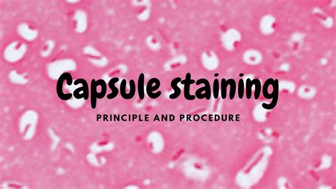 Capsule Staining Principle