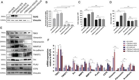 Tbx Promotes Progression Of Preinvasive Breast Cancer Cells By