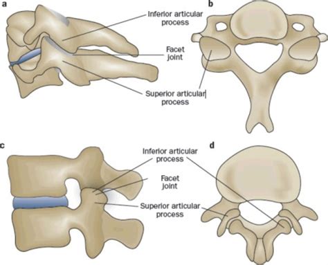 Cervical Osteoarthritis Physiopedia