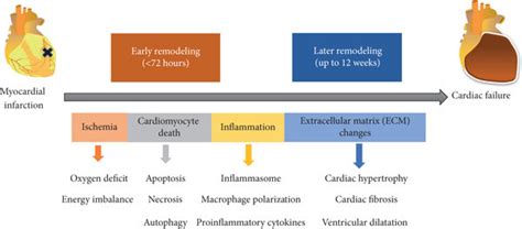 The Phases And The Main Pathological Changes In Post MI Cardiac