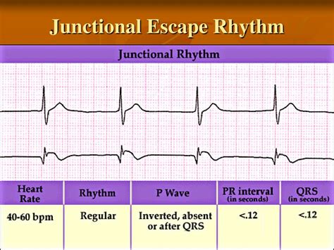 Ppt Electrocardiogram Powerpoint Presentation Free Download Id 297761