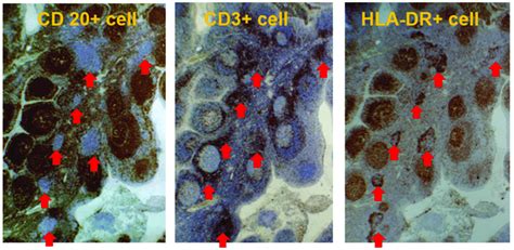 T Cell Nodules In Palatine Tonsil T Cell Nodules Red Arrows Download Scientific Diagram