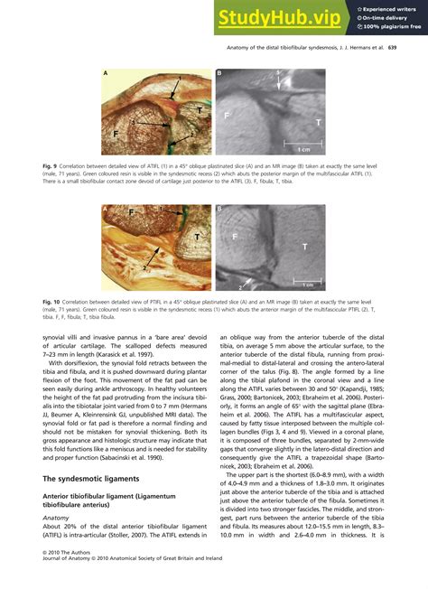 Anatomy Of The Distal Tibiofibular Syndesmosis In Adults A Pictorial