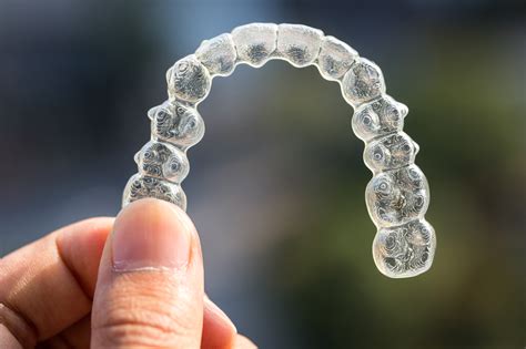 Can Invisalign Fix An Open Bite