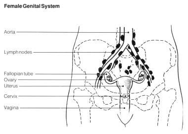 Pelvic Lymph Node Anatomy - Anatomical Charts & Posters