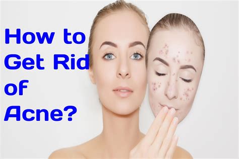 How To Get Rid Of Acne