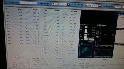 Nfs Numeration Formule Sanguine Youtube