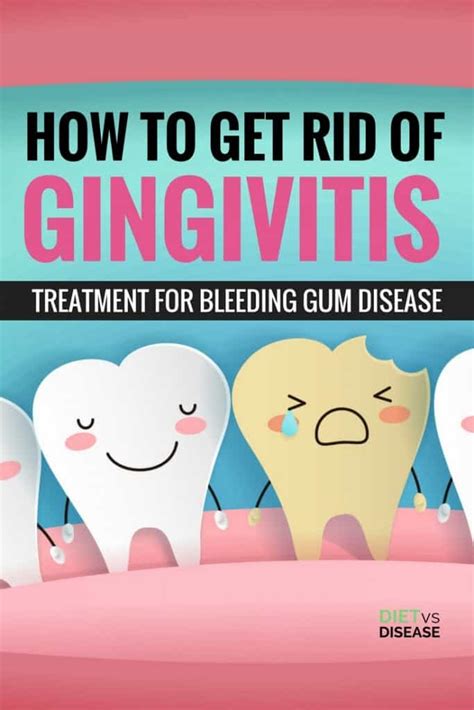 How To Get Rid Of Gingivitis Treatment For Bleeding Gum Disease Diet