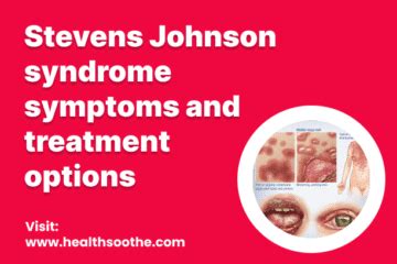 Stevens Johnson Syndrome Pictures Early Stages