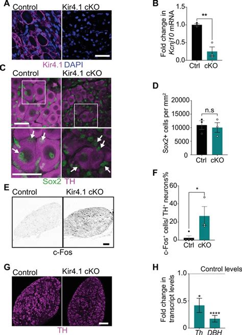 Satellite Glia Modulate Sympathetic Neuron Survival Activity And Autonomic Function Elife