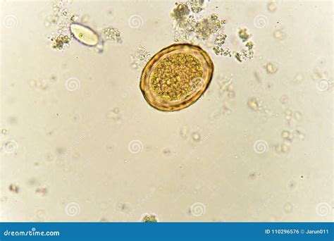 Egg Of Ascaris Lumbricoides In Stool Stock Photo Image Of Disease