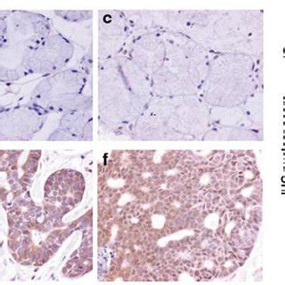 Sry Related High Mobility Group Box 4 Sox4 Immunohistochemistry