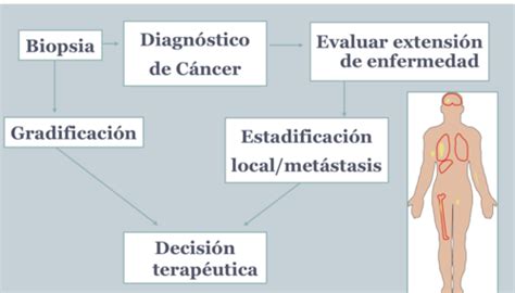 DIAGNÓSTICO Y ESTADIFICACIÓN ONCOLÓGICA Flashcards Quizlet