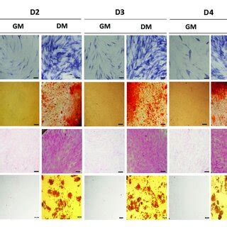 Multilineage Differentiation Potential Of BM MSCs Representative