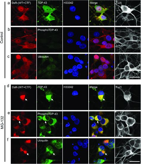 Formation Of Cytoplasmic TDP 43 Aggregates Is Accelerated By Proteasome