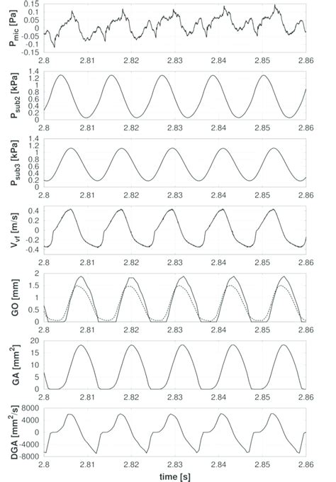 Measured And Evaluated Signals For The Vibrating Vocal Folds Model Type Download Scientific