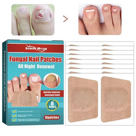 Pcs Box Fungal Nail Patches Ingrown Toenail Corrector Anti Fungal