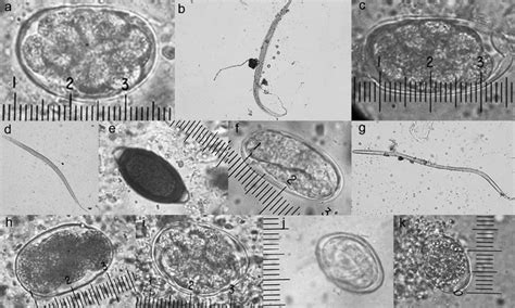 A Oesophagostomum Sp Egg 7023486 Mm B Oesophagostomum Sp