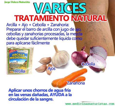 MEDICINA NATURAL TRATAMIENTOS NATURALES VARICES