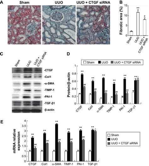 Treatment With Ctgf Sirna Plasmid Reduced Interstitial Fibrosis Of Uuo